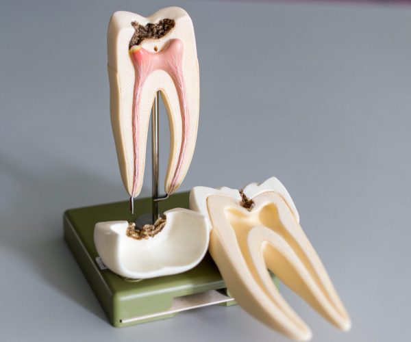 dental-assistant-introduction-dental-anatomy